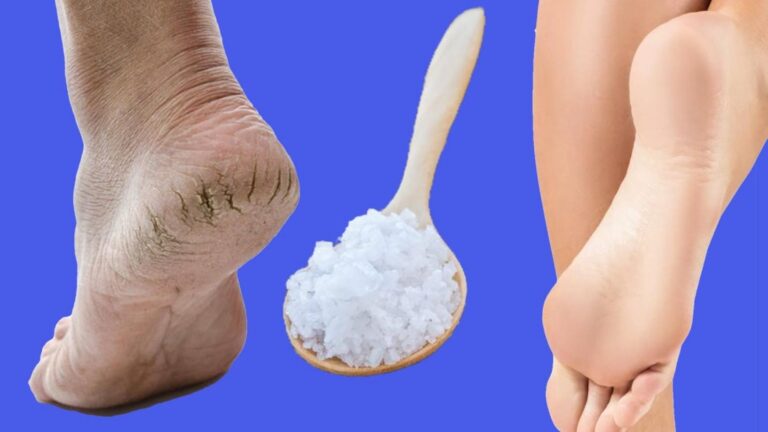 Dieser vergessene Trick macht rissige Fersen in nur wenigen Minuten weich wie Babyfüße…
