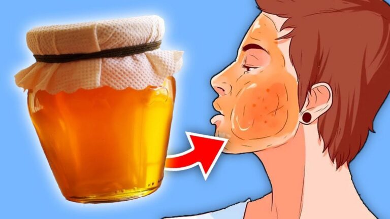 Diese einfache Maske mit Honig verwandelt deine Haut in wenigen Minuten …