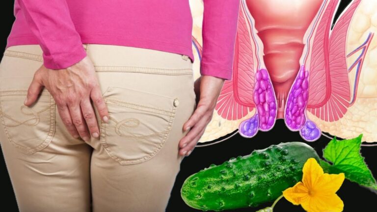Dieser einfache Trick hilft dir, Hämorrhoiden in nur 24 Stunden loszuwerden…