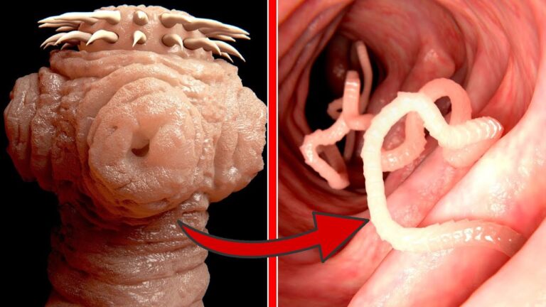 7 effektive Tipps, um versteckte Darmparasiten schnell loszuwerden! 💥