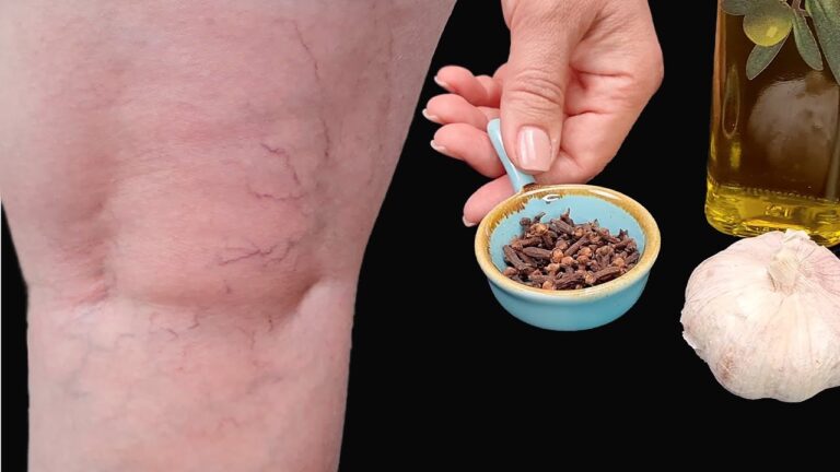 5 effektive Tipps gegen Beinschmerzen und Rheuma – So kann auch deine Mutter wieder gehen!
