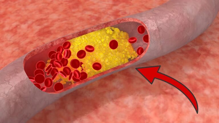 9 Lebensmittel, die deine Arterien reinigen und deine Gesundheit stärken!